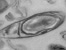 [thumbnail of Chapter 5 - Video 5.2 Tilt series of 200nm C. sporogenes endospore section]