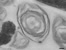 [thumbnail of Chapter 5 - Video 5.3 Tilt series of 200nm C. sporogenes endospore section]