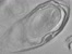 [thumbnail of Chapter 5 - Video 5.5 Tomogram of 200nm C. sporogenes endospore section]